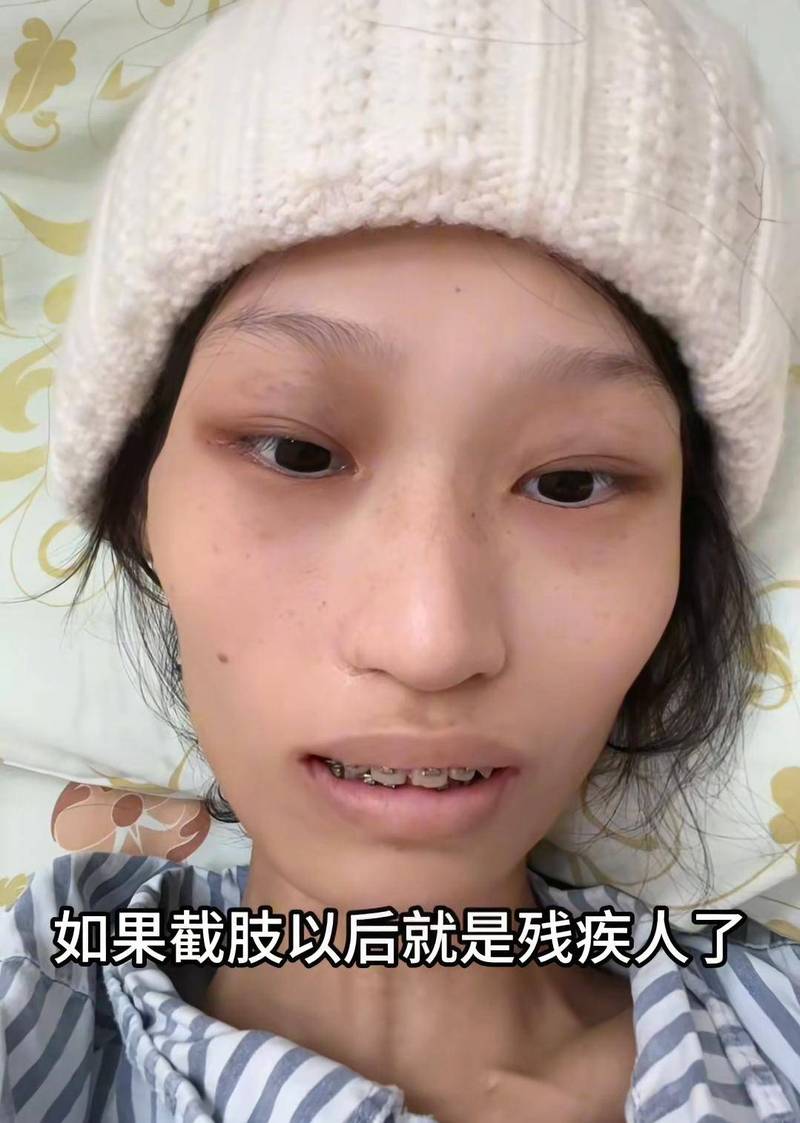 抗癌2年后发现误诊,21岁女子抗癌2年后发现误诊