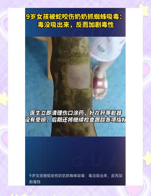 被蛇咬反抓蛇再遭咬,被蛇咬反抓蛇再遭咬伤